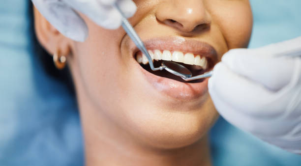 Best Emergency Root Canal Treatment in Seadrift, TX